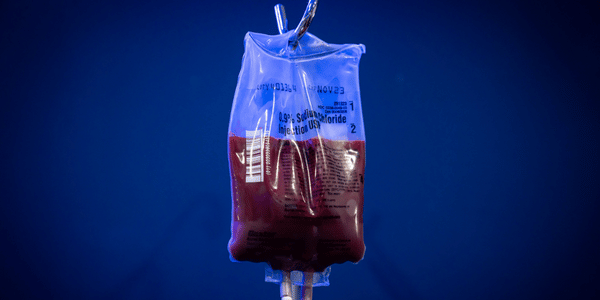 UV IV ozonotherapy